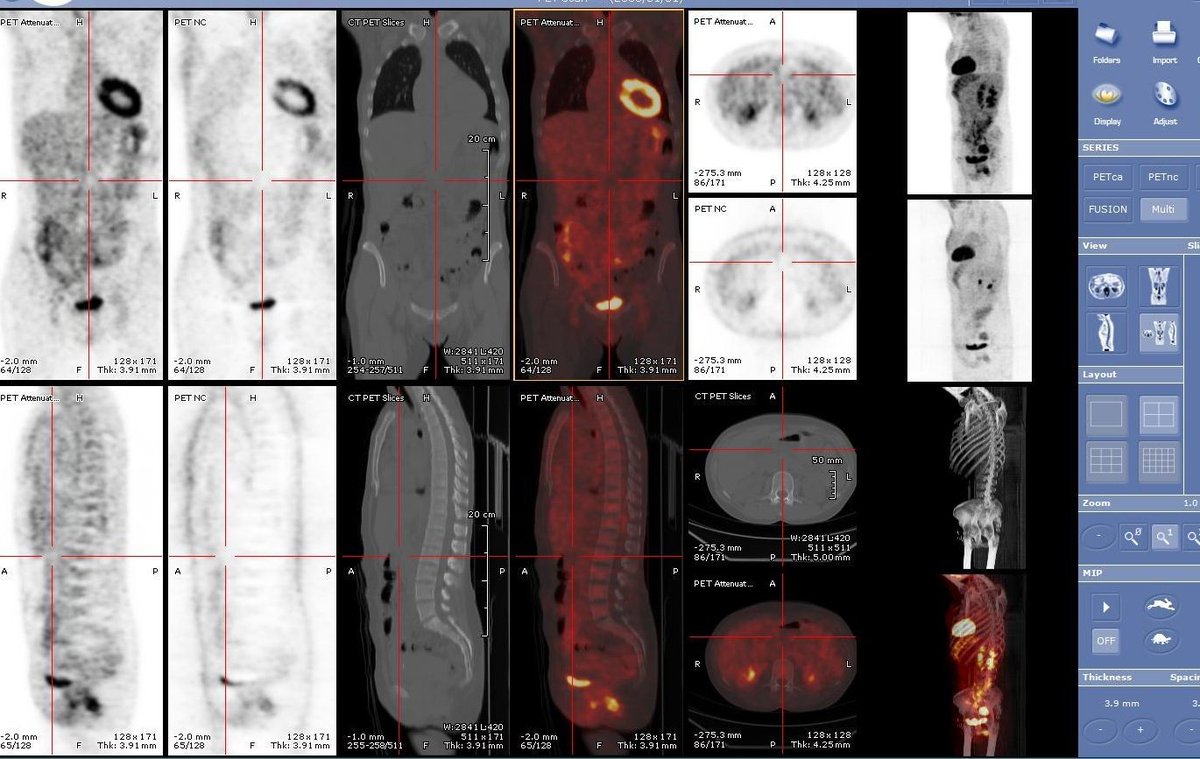سماء الأشعة ☢ (@radiologysky) on Twitter photo ماهو الطب النووي؟
ماهي فوائده؟
ماهي أبرز التقنيات؟
كل هذا وأكثر في مقالنا الجديد من إعداد
أ- موسى معيني <a href="/MousaRad1/">Mousa Maeni</a>
أخصائي الأشعة التشخيصية.
radiologysky.com/blog.php?blog=… ماهو الطب النووي؟
ماهي فوائده؟
ماهي أبرز التقنيات؟
كل هذا وأكثر في مقالنا الجديد من إعداد
أ- موسى معيني <a href="/MousaRad1/">Mousa Maeni</a>
أخصائي الأشعة التشخيصية.
radiologysky.com/blog.php?blog=…