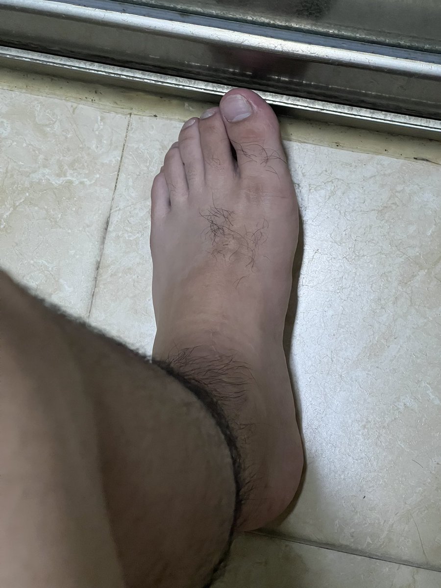 毛多到甚至脚背都长毛毛