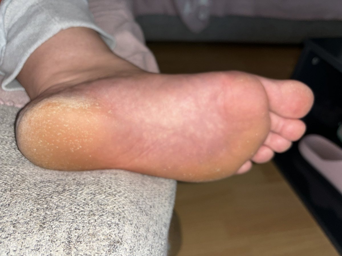 Dein schwanz würde auslaufen wenn ich dir befehlen würde meine Hornhaut ab zuraspeln!! 👅💦 

#feet #füße #fetisch #geldsklave #geldherrin