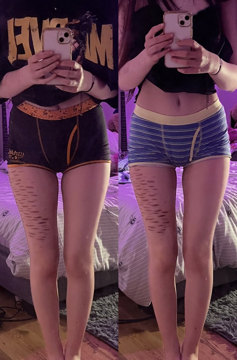 skinnyhorror's tweet photo. i’m still fat but here’s my thigh gap 2 weeks apart https://t.co/flBzTIIrum
