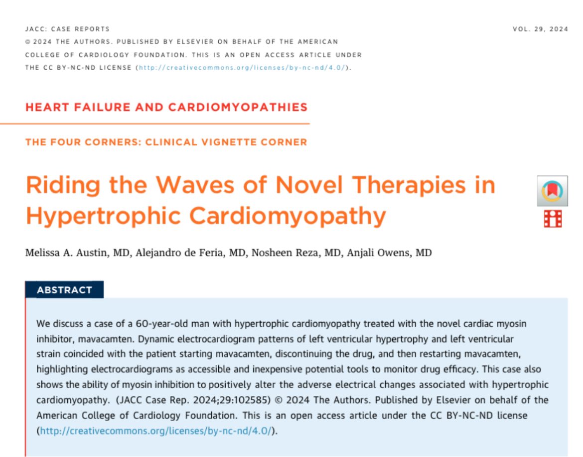 Melissa Austin, MD (@melissaaustinmd) on Twitter photo Can cardiac myosin inhibition alter adverse ECG changes associated with HCM? Check out our newly published case report! 🫀
<a href="/noshreza/">Nosheen Reza, MD, MS</a> <a href="/tikuowens/">Anjali Owens</a> @deFeriaMD
jacc.org/doi/10.1016/j.… Can cardiac myosin inhibition alter adverse ECG changes associated with HCM? Check out our newly published case report! 🫀
<a href="/noshreza/">Nosheen Reza, MD, MS</a> <a href="/tikuowens/">Anjali Owens</a> @deFeriaMD
jacc.org/doi/10.1016/j.…