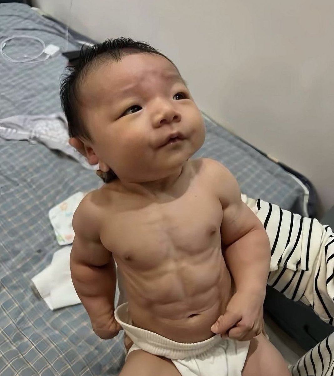 O böbreği öyle kaldırmayacaksın kardeşim