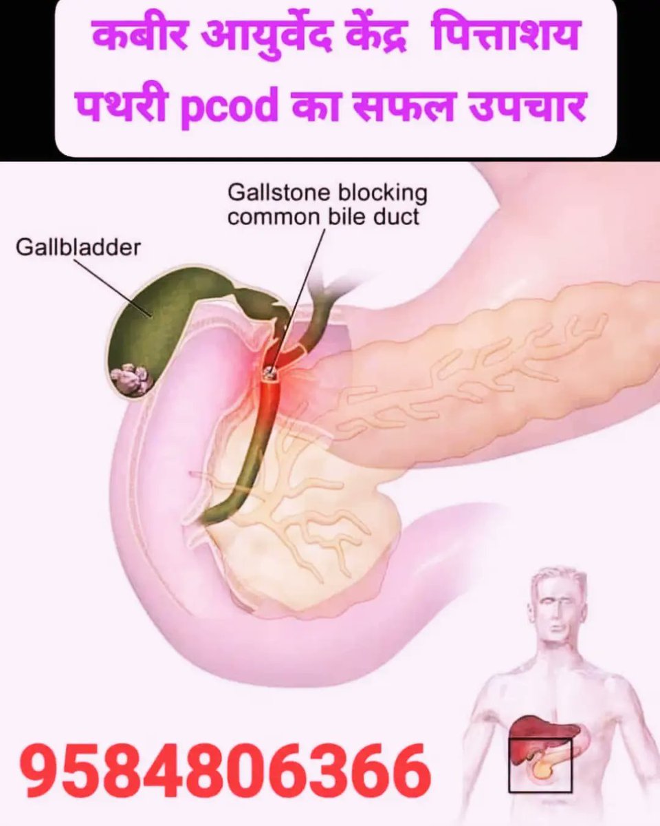 15 mm गालब्लेडर स्टोन (पित्त की पथरी) मात्र 40 दिनो मे पूरी तरह गल (डिजाॅल्व dissolve ) हुई।  हर्बल द्वारा
9584806366
instagram.com/p/DAeDIUWIaph/…