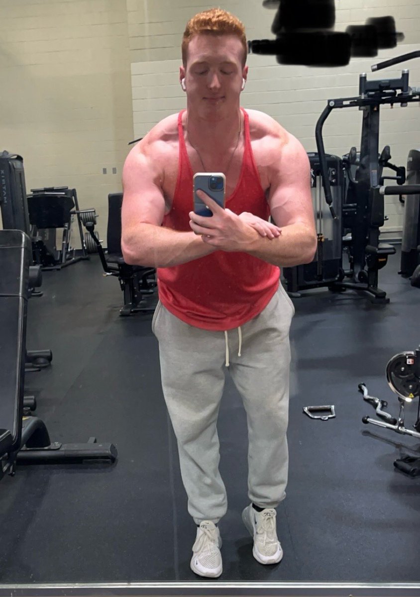 2019 vs 2024 (I don’t have an older picture)