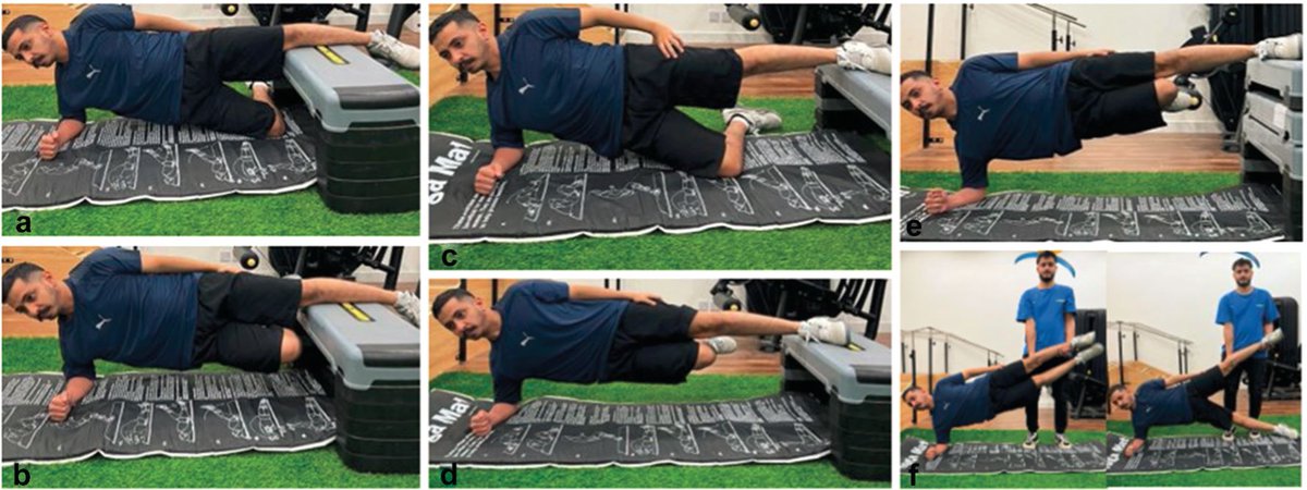 "The Effectiveness of the Copenhagen Adduction Exercise (CAE) on Improving Eccentric Hip Adduction Strength Among Soccer Players ⚽️ with Groin Injury"

👇👇👇

pubmed.ncbi.nlm.nih.gov/38376593/