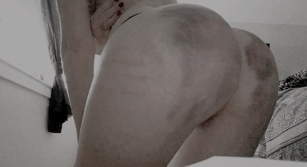 ᅠᅠ────ᅠᅠ𝖣𝗈𝖼𝗍𝗈𝗋. 𝖱𝗂𝖼𝖾 tweet media