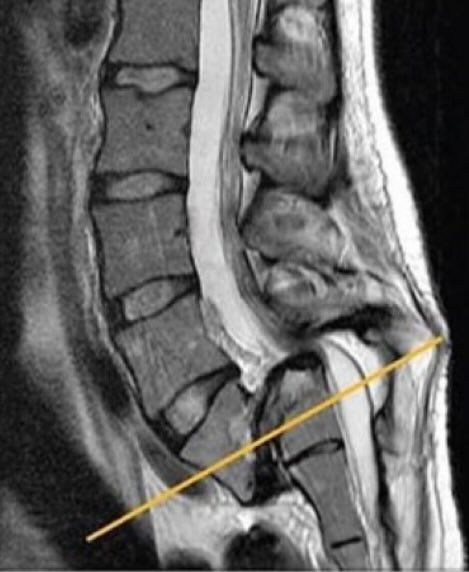 Oren Gottfried, MD tweet media