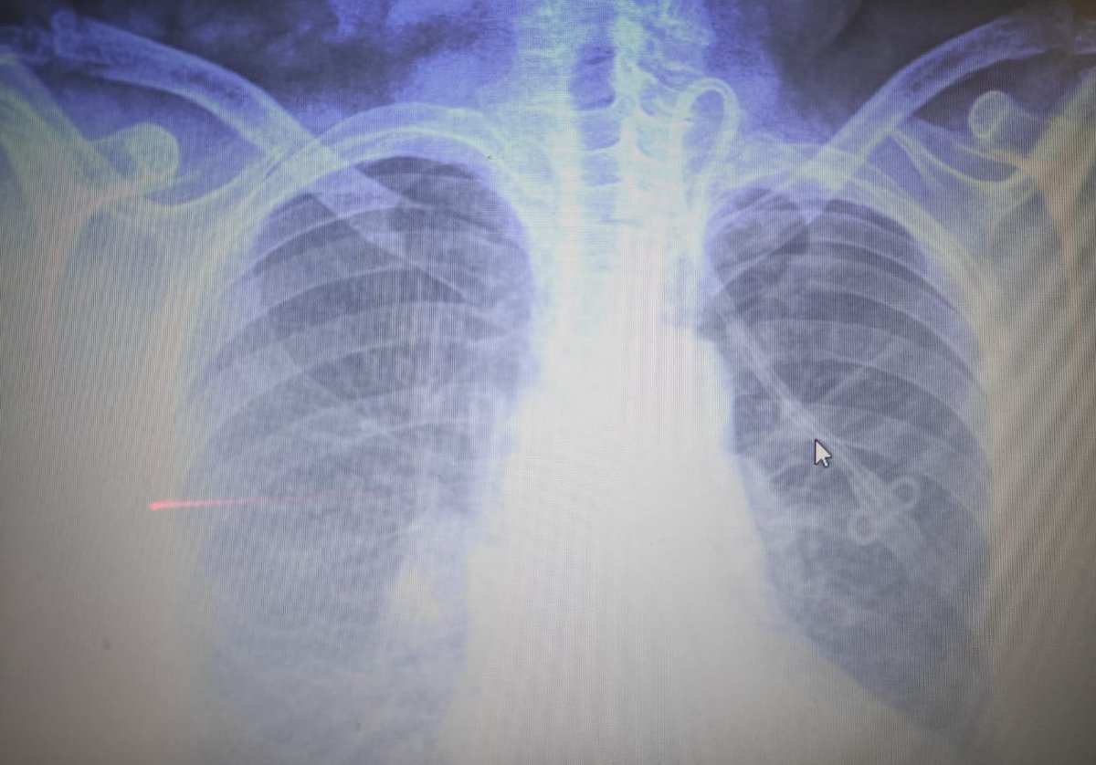 Nefrología Hospital Central de Chihuahua tweet media