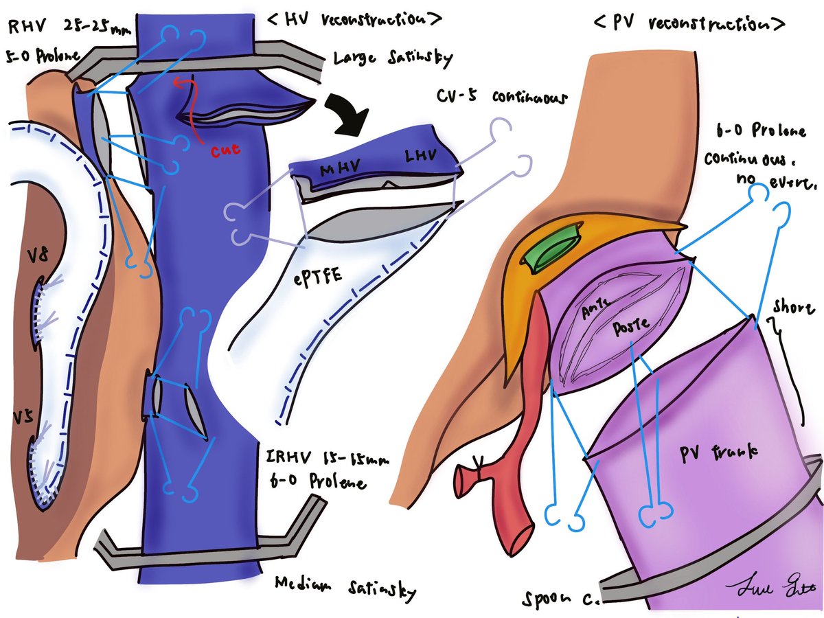 Toru Goto, MD tweet media