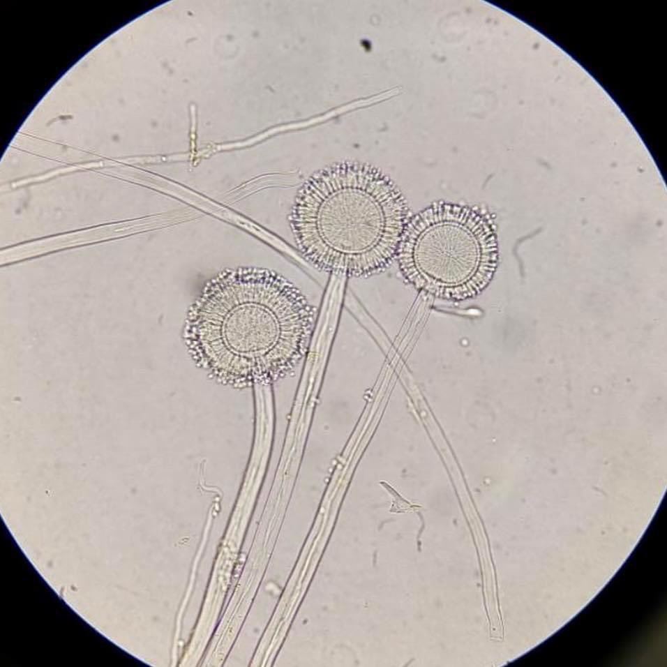 LabClinicoDG's tweet photo. Aspergillus 🔬🍄‍🟫

https://t.co/nGogayyJ32

#micologia https://t.co/bFuOszJqKG