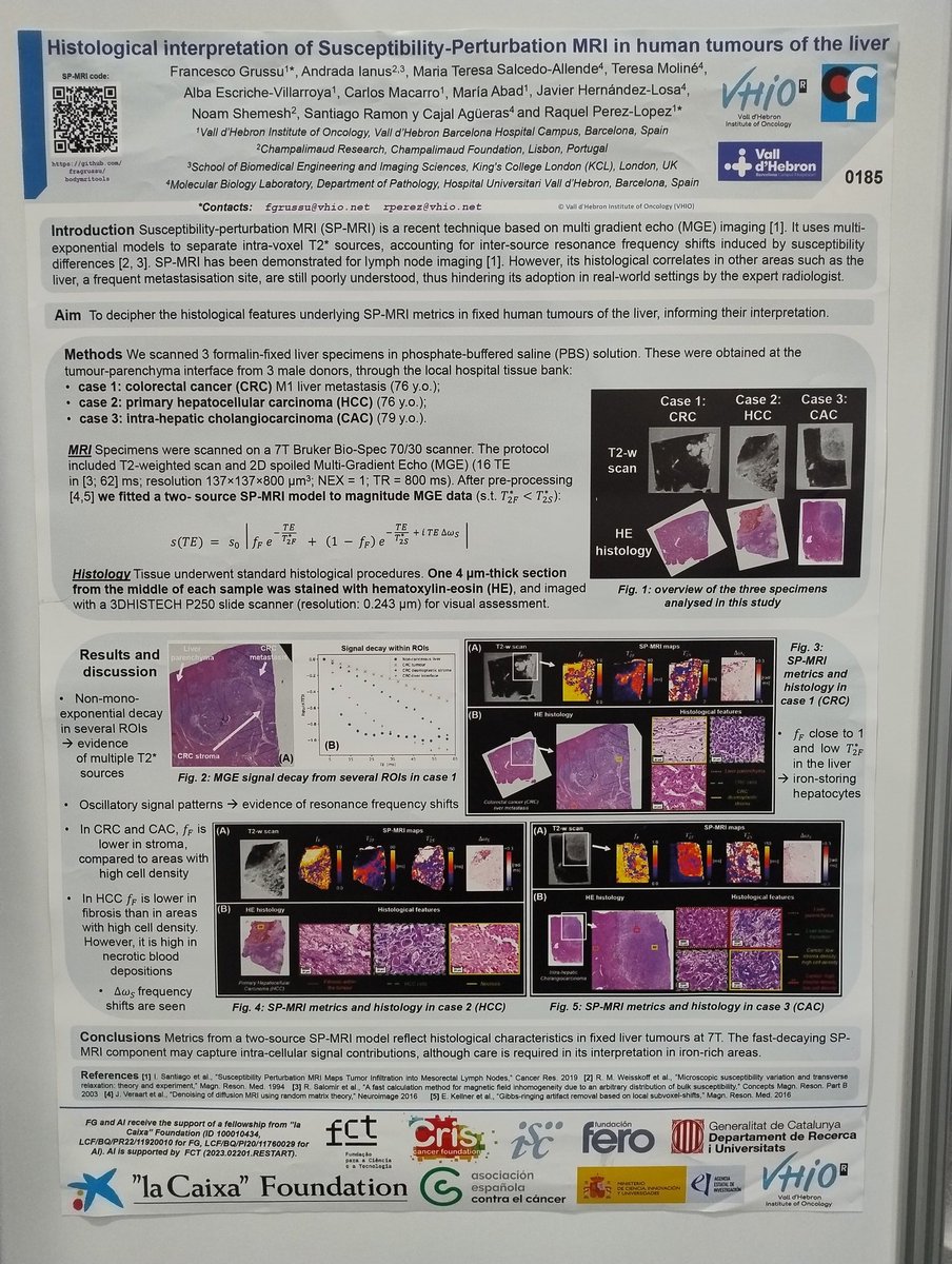 Francesco Grussu (@fragrussu) on Twitter photo TODAY at <a href="/ESMRMB/">ESMRMB</a> I am delighted to present the histological correlates of Susceptibility Perturbation #MRI in #liver #cancer - a collaboration between <a href="/RaqPerezLopez/">Raquel Perez-Lopez</a>'s <a href="/VHIO/">Vall d’Hebron Institute of Oncology (VHIO)</a> <a href="/radiomicsVHIO/">Radiomics Group</a> and <a href="/ShemeshL/">Shemesh Lab</a> <a href="/AndradaIanus/">Andrada Ianus</a> from Champalimaud Foundation in Lisbon. Poster 185 at 16:15 TODAY at <a href="/ESMRMB/">ESMRMB</a> I am delighted to present the histological correlates of Susceptibility Perturbation #MRI in #liver #cancer - a collaboration between <a href="/RaqPerezLopez/">Raquel Perez-Lopez</a>'s <a href="/VHIO/">Vall d’Hebron Institute of Oncology (VHIO)</a> <a href="/radiomicsVHIO/">Radiomics Group</a> and <a href="/ShemeshL/">Shemesh Lab</a> <a href="/AndradaIanus/">Andrada Ianus</a> from Champalimaud Foundation in Lisbon. Poster 185 at 16:15