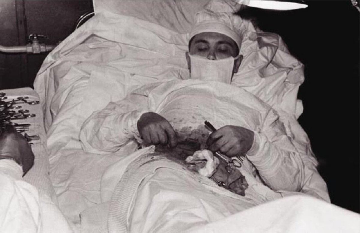 Rus doktor Leonid İvanoviç Rogozov 1961 yılında kendi apandisit ameliyatını kendisi yapmıştır. Ameliyat süresi 2 saat sürmüştür.
