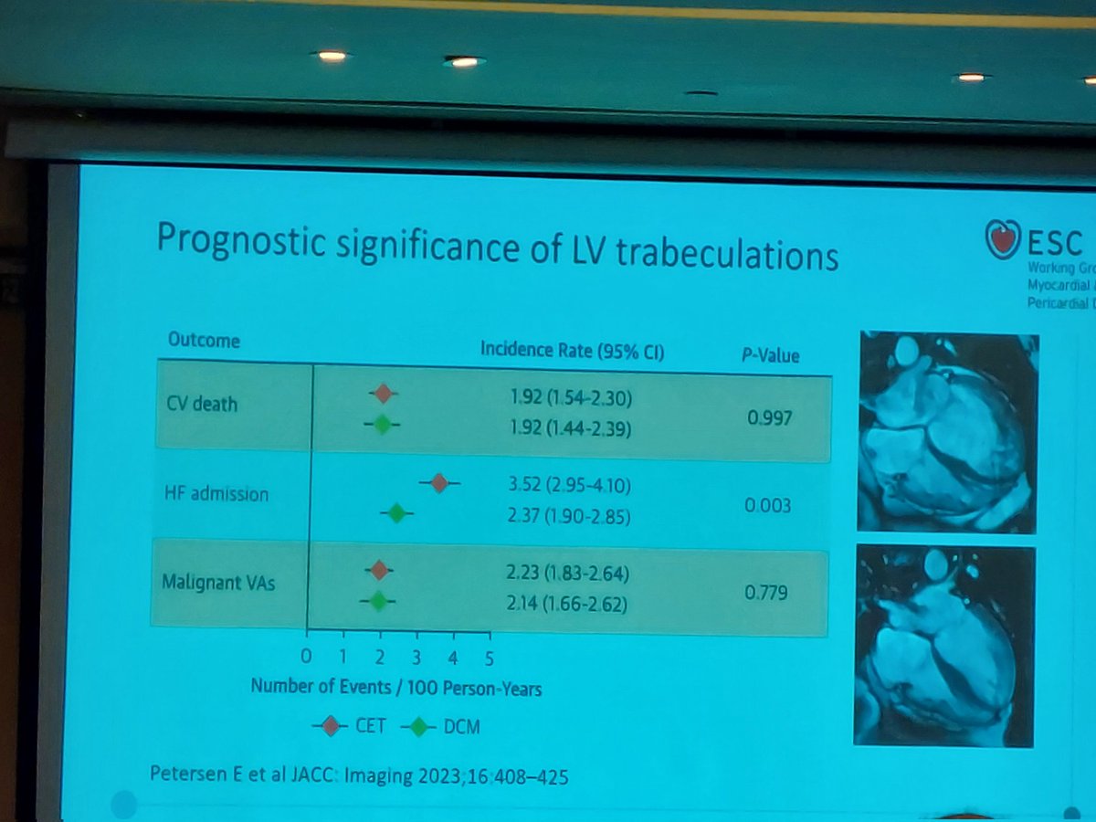AKasiakogias's tweet photo. 💢Great kick-off of the ESC Myocardial &amp; Pericardial Diseases 2024 Meeting in Athens.

💯Prof Papadakis gives an exciting talk on present and future of LVNC.

#cardiotwitter #medtwitter
#CardioEd #ESCardioEd #EscYoung #MPD2024

@MichaelPapadak2 https://t.co/gtF02cD99I