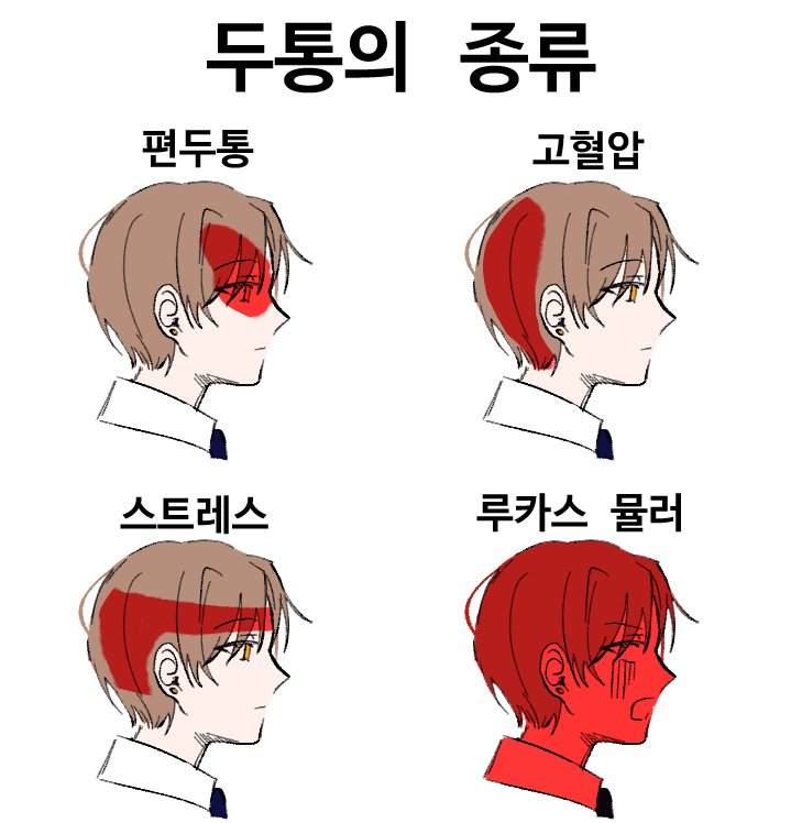Sirius_B___'s tweet photo. 두통의 종류 https://t.co/EtG3H3fVP4