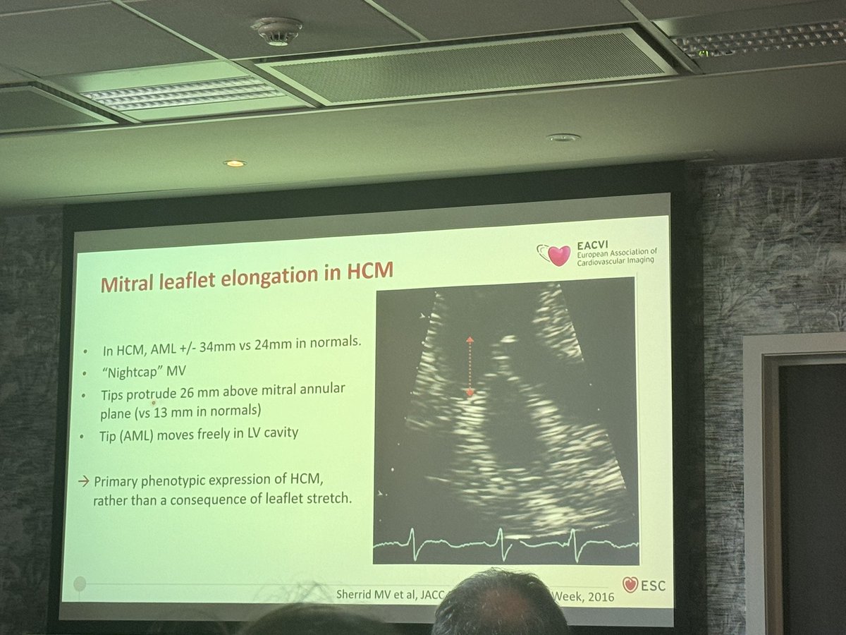 Andreea Motoc (@motocandreea) on Twitter photo 🔥 📖 Fantastic #EACVI #HCM Masterclass, learning from the best about #multimodalityimaging in #HCM, always #echofirst but important to know #whyCMR and indeed #yesCCT <a href="/Cosyns/">Cosyns Bernard</a> <a href="/DroogmansSteven/">Steven Droogmans</a> <a href="/RJurcut/">Ruxandra Jurcut</a> <a href="/Ph_Bertrand/">Philippe B. Bertrand</a> <a href="/VDelgadoGarcia/">Victoria Delgado</a> <a href="/ThorEdvardsen/">Thor Edvardsen</a> <a href="/XGalloo/">GallooX</a> <a href="/EScheirlynck/">Esther Scheirlynck</a> <a href="/gpontone1/">Gianluca Pontone</a> 🔥 📖 Fantastic #EACVI #HCM Masterclass, learning from the best about #multimodalityimaging in #HCM, always #echofirst but important to know #whyCMR and indeed #yesCCT <a href="/Cosyns/">Cosyns Bernard</a> <a href="/DroogmansSteven/">Steven Droogmans</a> <a href="/RJurcut/">Ruxandra Jurcut</a> <a href="/Ph_Bertrand/">Philippe B. Bertrand</a> <a href="/VDelgadoGarcia/">Victoria Delgado</a> <a href="/ThorEdvardsen/">Thor Edvardsen</a> <a href="/XGalloo/">GallooX</a> <a href="/EScheirlynck/">Esther Scheirlynck</a> <a href="/gpontone1/">Gianluca Pontone</a>