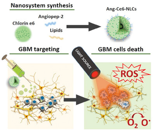 Gianni Ciofani (@ciofanigianni) on Twitter photo An innovative approach for photodynamic therapy in glioblastoma: Our latest paper on Advanced Healthcare Materials
onlinelibrary.wiley.com/doi/full/10.10…
<a href="/AIRC_it/">Fondazione AIRC per la ricerca sul cancro</a> 
<a href="/IITalk/">IIT</a> An innovative approach for photodynamic therapy in glioblastoma: Our latest paper on Advanced Healthcare Materials
onlinelibrary.wiley.com/doi/full/10.10…
<a href="/AIRC_it/">Fondazione AIRC per la ricerca sul cancro</a> 
<a href="/IITalk/">IIT</a>