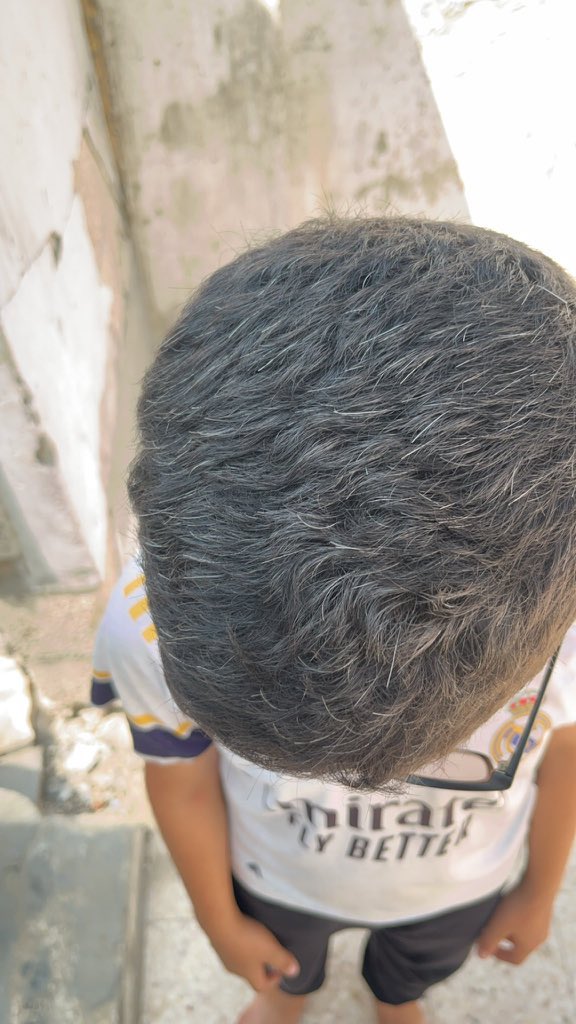 Mo7mmd30's tweet image. I BEG U DONT SKIP FOR IMPORTANCE!!

My bro Amir JUST 12Y.O! ,his hair is starting to turn white, Whenever Amir hears the sound of bombing, he gets scared and starts crying, saying:“I dont want all of my hair to turn white”

HELP ME EVACUATE AMIR FROM GAZA

gofund.me/a6175c89