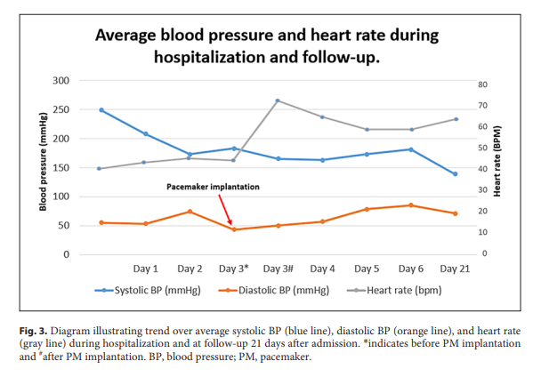 An Unexpected Cause of Severe #Hypertension and #Bradycardia: The Role of Hemodynamic Assessment by Echocardiography
➡️ ow.ly/nvWZ50Tw4e4
✍️ Myrmel G. et al.
📖 #Pulse
#Hypertension #Hemodynamics