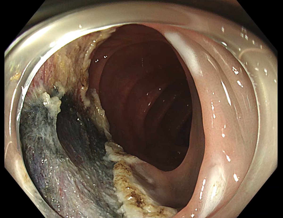 Pedro J. Rosón tweet media