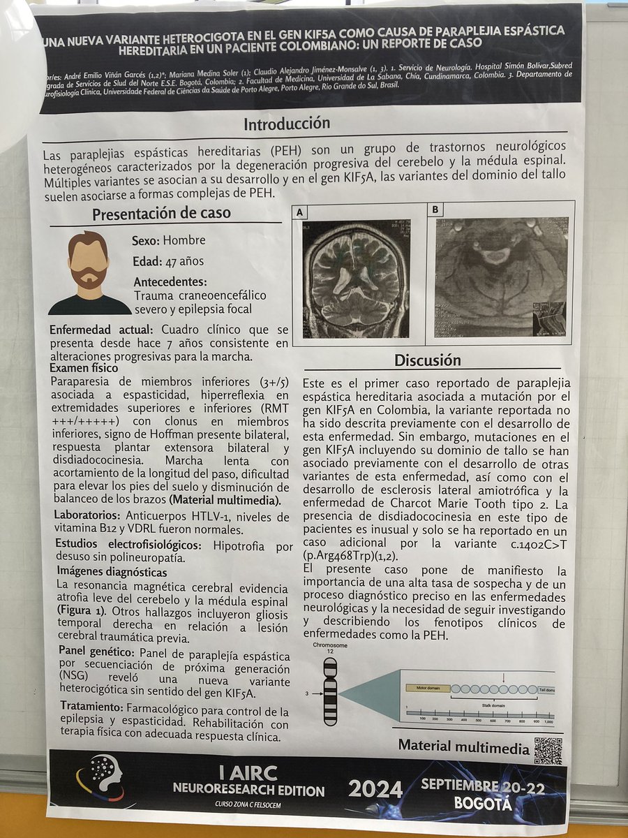 MarthaMilenaSi2's tweet photo. @ASCEMCOL @IFMSA @IFMSASpain @FELSOCEM @ColneColombia @UNALOficial @SEDOF_ORG @EgresadosUN_Nal @PrensaUNAL @antropologies Hoy FASCINADA en la Sesión de Pósters del Congreso I AIRC #NeuroResearch @ASCEMCOL @ColneColombia @UNALOficial @EgresadosUN_Nal con @medina_sol98103 @CAlejandroneuro @SubRedNorte @neurosubnorte hablando sobre #CaseReport #Paraplegia espástica hereditaria https://t.co/rLuszeutwR