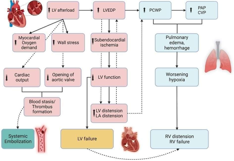 🔴 Contemporary approach to cardiogenic shock care: a state-of-the-art #2024Review #openaccess  
 frontiersin.org/articles/10.33…
#CardioTwitter #lipid #Cardiology #cardioEd
#CardioEd #CardioTwitter #cardiology #MedEd #medtwitter
