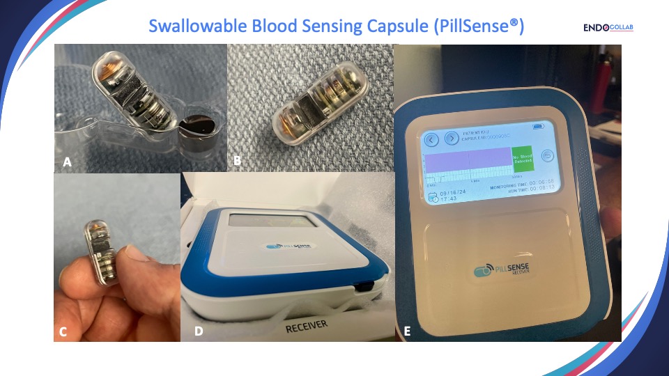 theendoscopist's tweet photo. Technical Review: PillSense ®, a Novel Swallowable Capsule to Detect Upper Gastrointestinal Bleeding

Read Now: https://t.co/U1Beh9yfHf https://t.co/IXRokOct2c