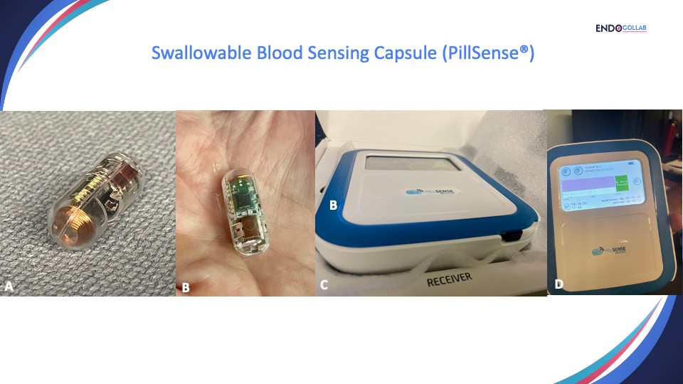 theendoscopist's tweet photo. Technical Review: PillSense ®, a Novel Swallowable Capsule to Detect Upper Gastrointestinal Bleeding

Read Now: https://t.co/U1Beh9yfHf https://t.co/IXRokOct2c