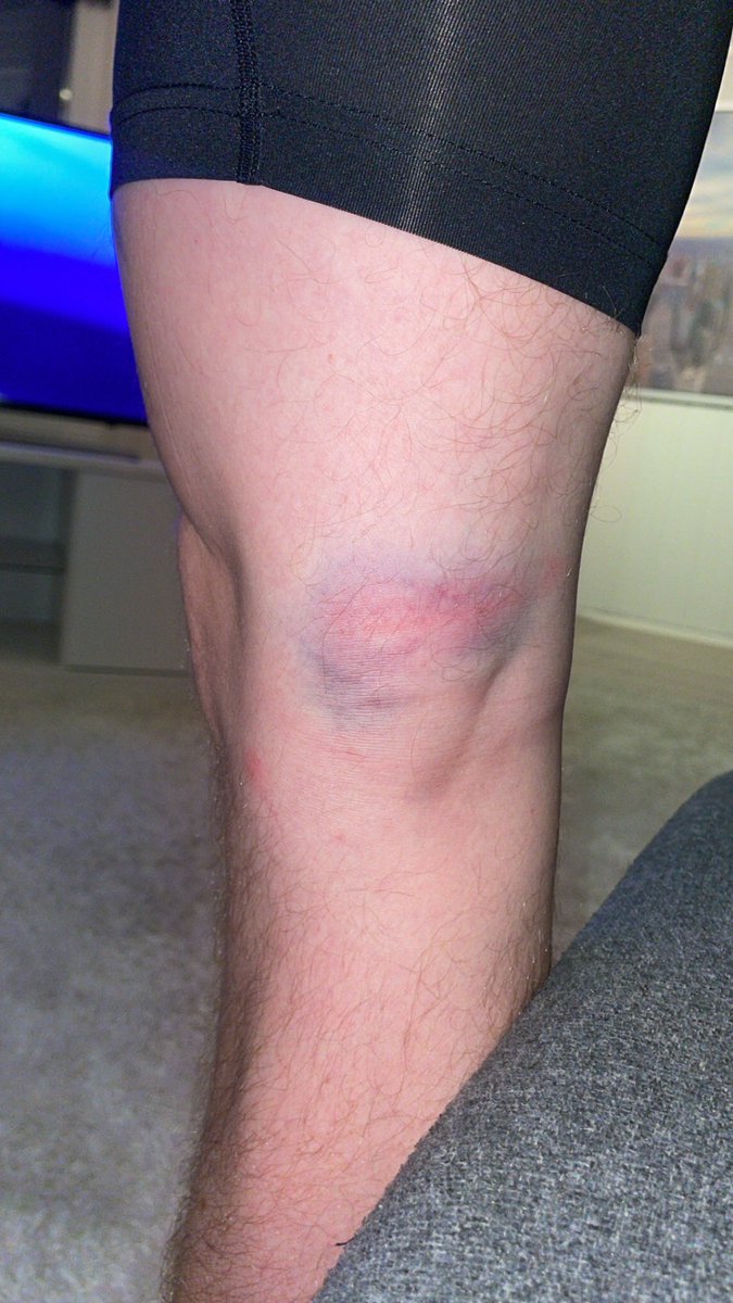 Marcus Bryhnisveen tweet media