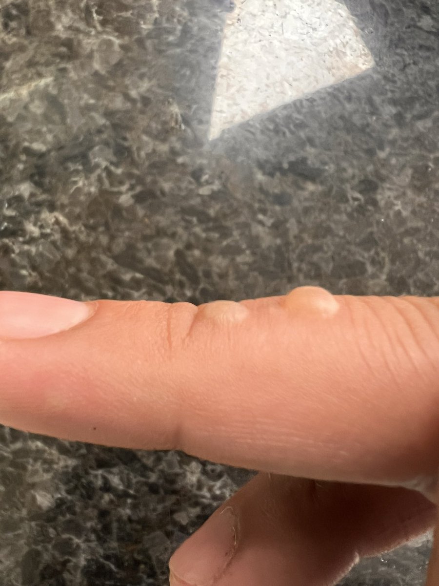 Gracias por el recuerdo Sabrita <a href="/SoyYoDeNuevo22/">Un tal albo 🍻</a>