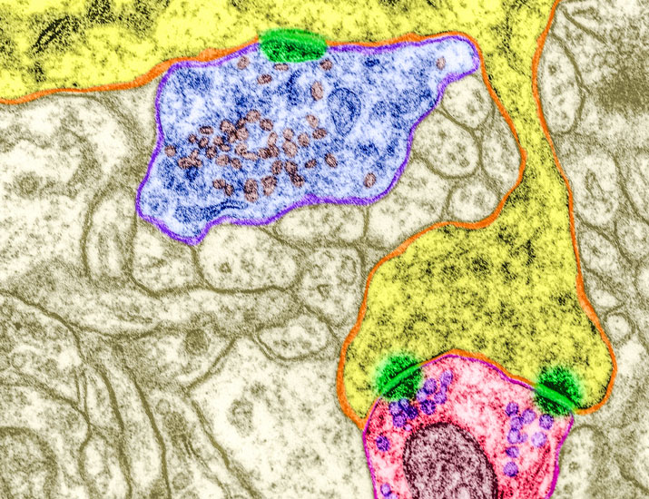 scisignal's tweet photo. Scientists recently dissected a #phosphorylation cascade critical for the phenomenon of #AversiveLearning, which enables the prediction and avoidance of dangerous situations but can become dysfunctional in disorders such as #autism. @FHU_ICBS #neuroscience https://t.co/DUoUH0m2ey https://t.co/52cHmMwHhh