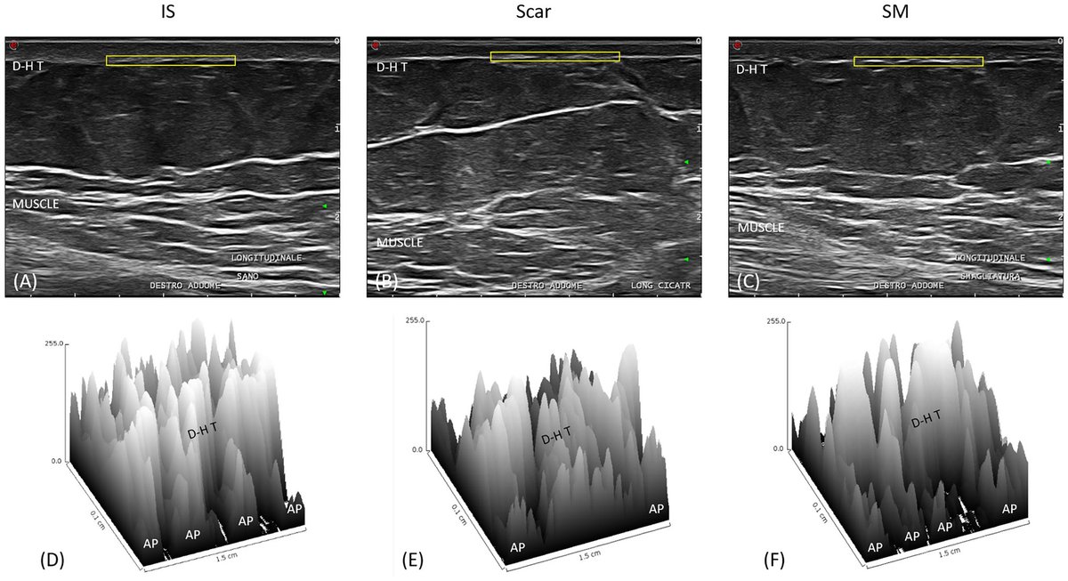 Journal Ultrasound tweet media