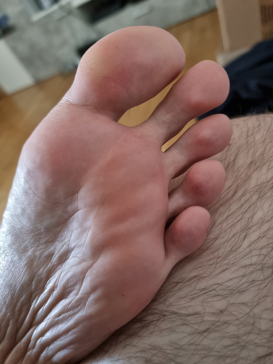 YoungBoyFeet44's tweet photo. Sicher gefallen dir meine Zehen so nahe #feet #füße https://t.co/JvosWRINLZ