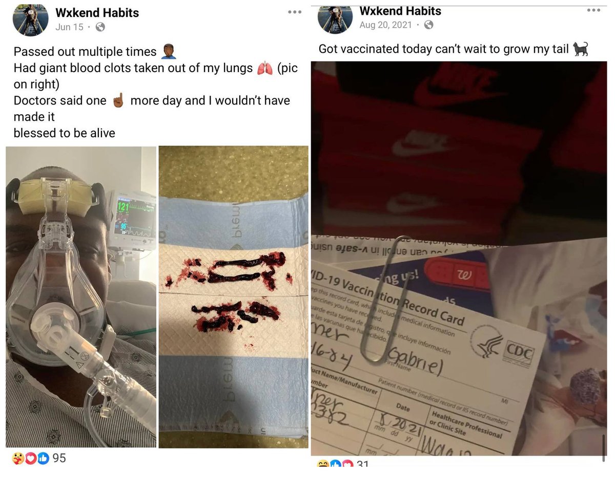 Gabriel was cracking jokes when he got his COVID-19 Vaccine on Aug.20, 2021.

June 2024: "Had giant clots taken out of my lungs...doctors said one more day and I wouldn't have made it"

The COVID-19 mRNA Vaccinated continue to "Clot Suddenly" 

#DiedSuddenly