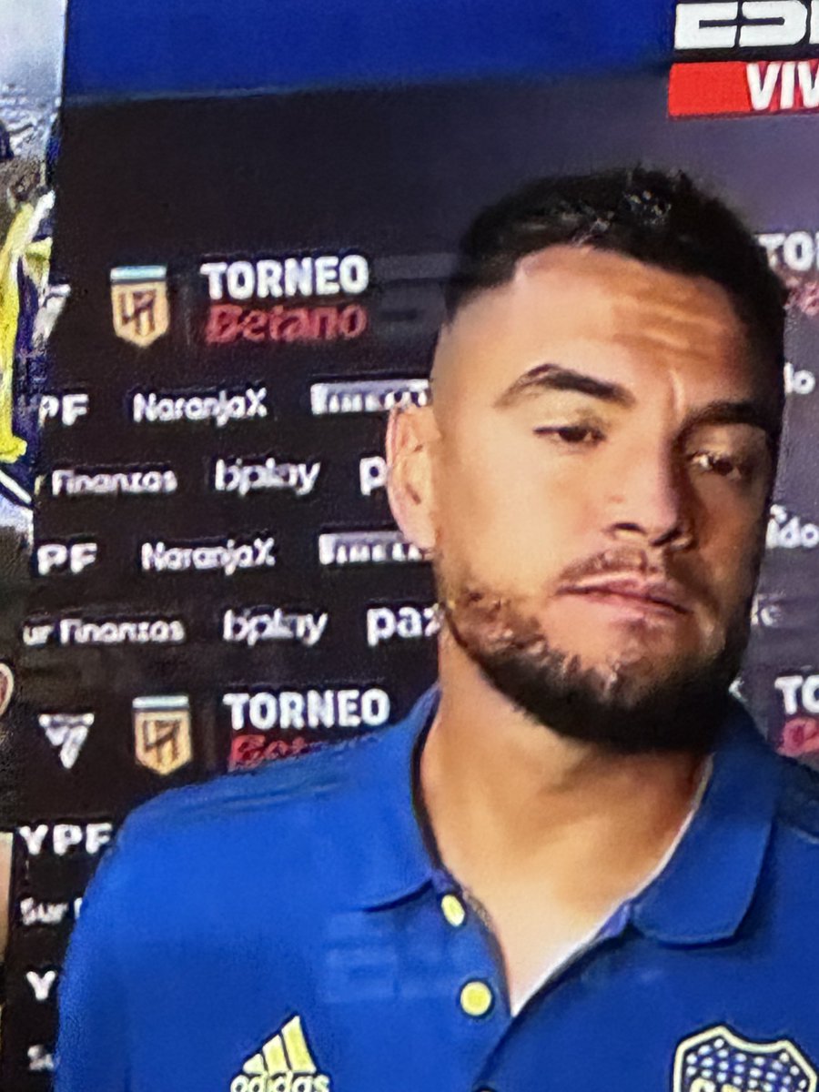 Muy bien chiquito romero pidiendo disculpas,muy autocrítico,más allá de haber reaccionado estuvo lúcido en bajarle un cambio a la cosa .