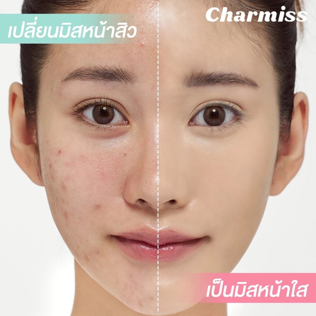 ￼Charmiss Matte All Day Acne Cushion SPF 50 PA++++ 02 Natural beige 8 g คุชชั่นสำหรับผิวเป็นสิว เนื้อแมทท์ ขนาด 8 กรัม

s.shopee.co.th/1B3kdNKfd5