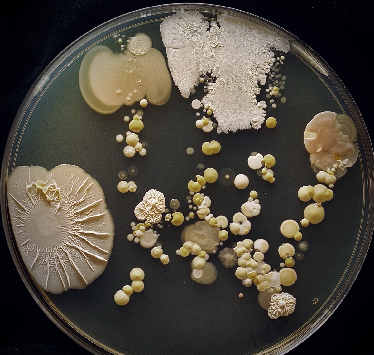 tasturm1's tweet image. #DescribeThatMicrobe Just finished looking at the last of the #Handprints for the HSI STEAM event @CabrilloCollege Some interesting colors and textures! @ASMicrobiology @HardyDiagnostic #SciComm #Science #microbiology
