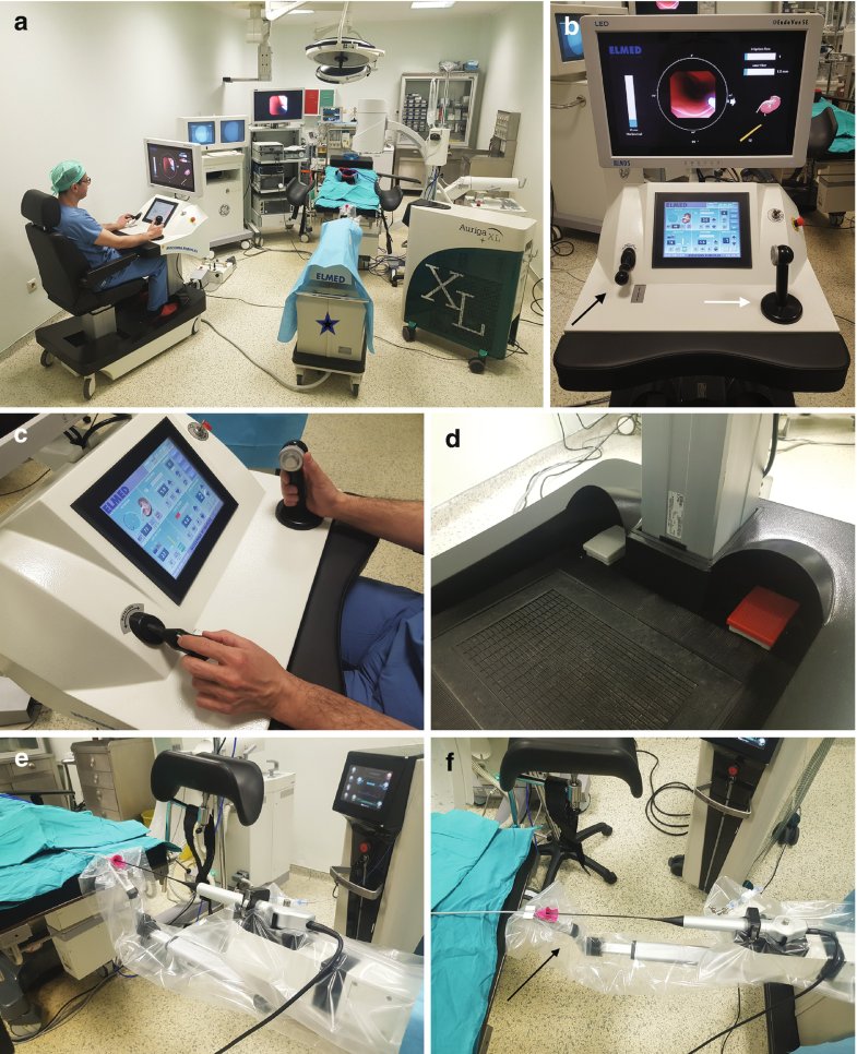 thelithomedia's tweet photo. 💪 Increased Reach &amp; Dexterity
Tough anatomy? No problem. Avicenna Roboflex provides enhanced flexibility and precise movement, making complex cases easier to handle. #RoboticsInUrology #Urology #Ureteroscopy #AUA25 #AvicennaRoboflex https://t.co/MSiFeLjJdm