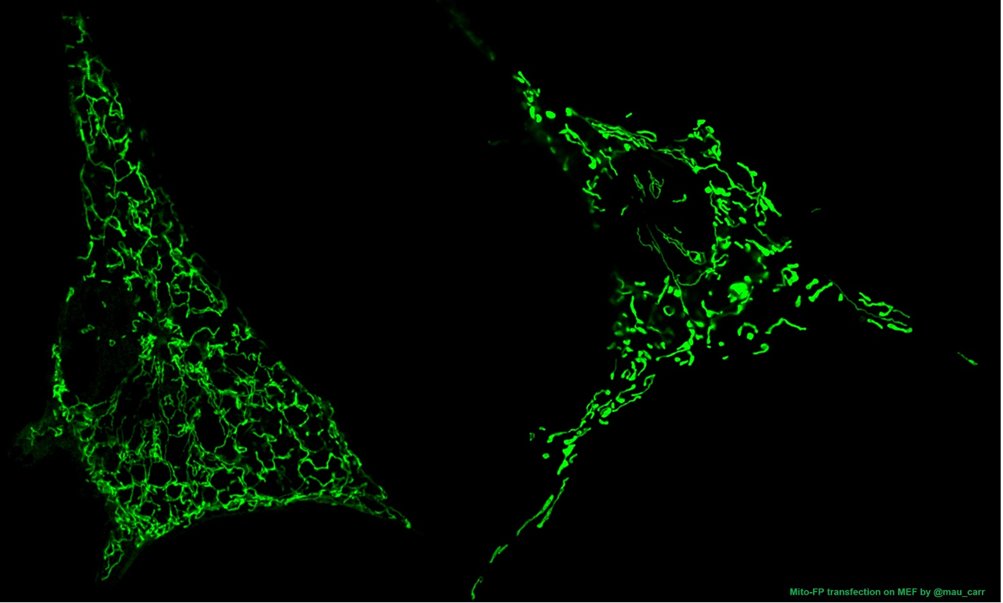E-mit (@emit38935125) on Twitter photo Yesterday, #LightUpForMito was shining a spotlight on mitochondria around the globe. We're joining the movement by spreading the green light from mitochondria in our cell models!💚 Thank you <a href="/mau_carr/">Mauricio Cárdenas-Rodríguez</a> for the mitochondria images!#MitoAwareness #WorldMitoWeek2024 Yesterday, #LightUpForMito was shining a spotlight on mitochondria around the globe. We're joining the movement by spreading the green light from mitochondria in our cell models!💚 Thank you <a href="/mau_carr/">Mauricio Cárdenas-Rodríguez</a> for the mitochondria images!#MitoAwareness #WorldMitoWeek2024