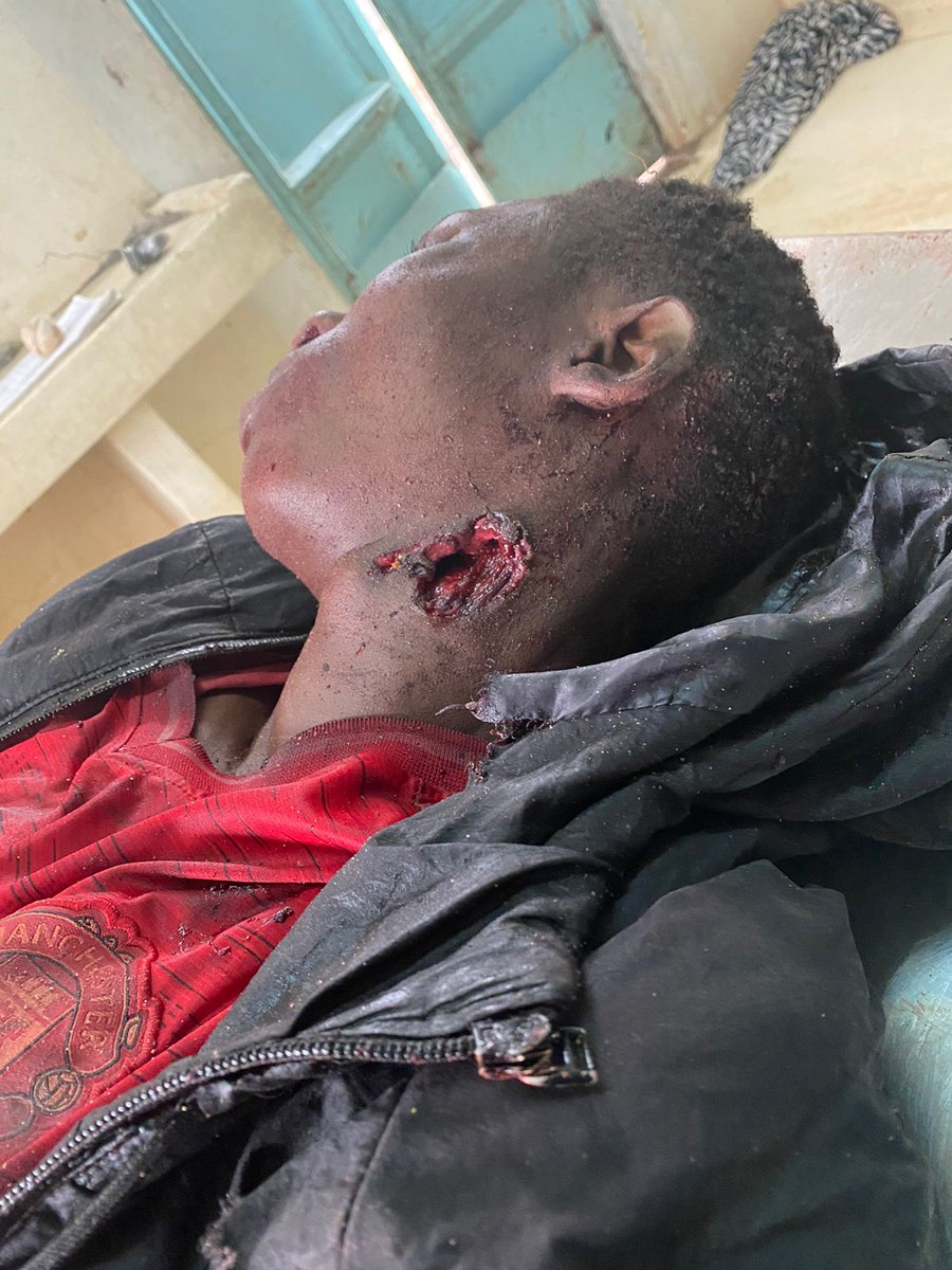 SelectorMwiti's tweet photo. Kenyans lives matter.end police brutality.#BanRutoAtUNGA7.
#Kenyanslivesmatter.
Retweet and make it an Ashtag.
Together we stand  to end this. https://t.co/0bQ8EnUsON