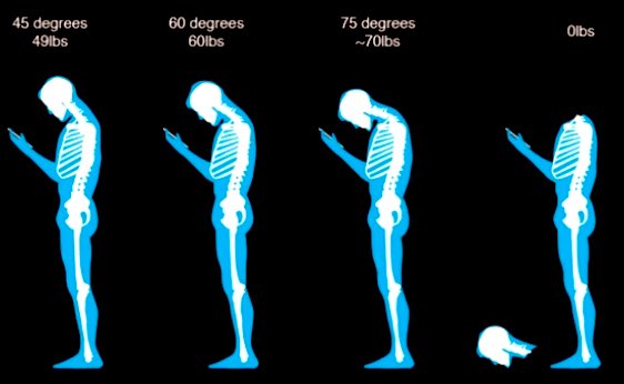 JohnFlutter's tweet image. How heavy is your head scrolling 𝕏?
“Every inch of forward head posture adds 10 pounds to the spine.”
