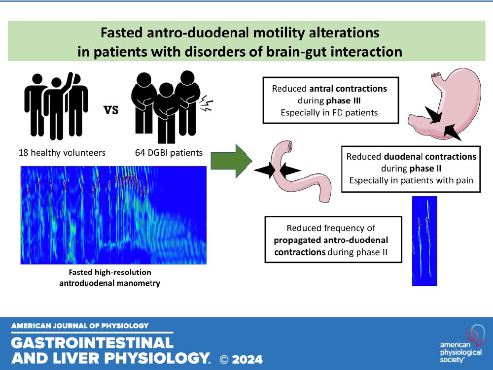Patients with disorders of gut-brain interaction have abnormal antroduodenal motility. 

#MedTwitter #GITwitter #motility 

journals.physiology.org/doi/abs/10.115…