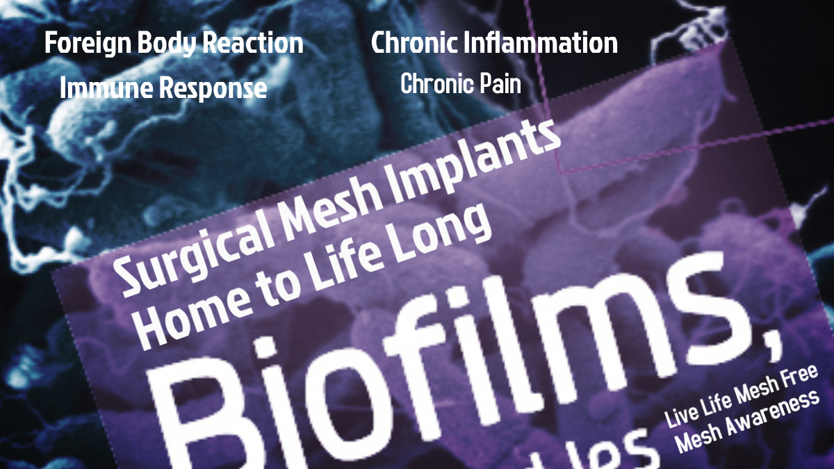 WCmeshfighter's tweet photo. W/O my Pain Meds, my Quality of Life has slowed down tremendously & causing underlining side effects, my body isn't doing well & it's scary to think what will happen once it's all taken away in October! I am nt an opioid addict, I am mesh injured 4 life. #banmesh #ChronicPain https://t.co/bqYLv4phRu