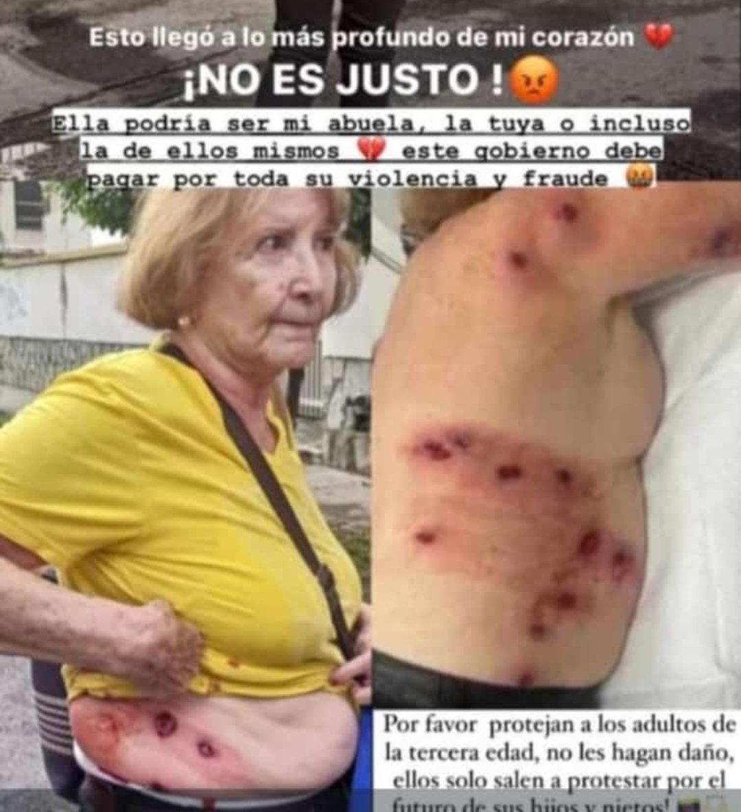 lbertoortiz's tweet image. si trata Miley a la tercera edad en Argentina, por no estar de acuerdo con su reforma pensional, ningún medio en Colombia te lo dice por temor a volver a perder las elecciones presidenciales en 2026.