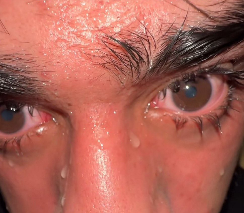 when my lead told me 3 times how to fix the bug and im still confused