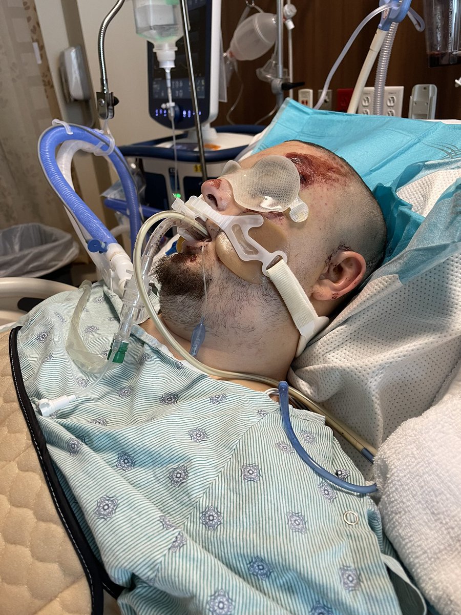 BrokenNoggin's tweet photo. As a Christian we worship, and give thanks to the lord on Sundays. Today, I thank God for saving me physically, and spiritually. These are pictures of me at the start of my journey of recovery after my Traumatic Brain Injury. We don’t know how long we have on earth. Hug someone you love today. Support, and be kind to one another. This is a safe space, if you have any questions or prayer requests please do not hesitate to let me know! #TBIAwareness #TBI #Christian #FaithJourney