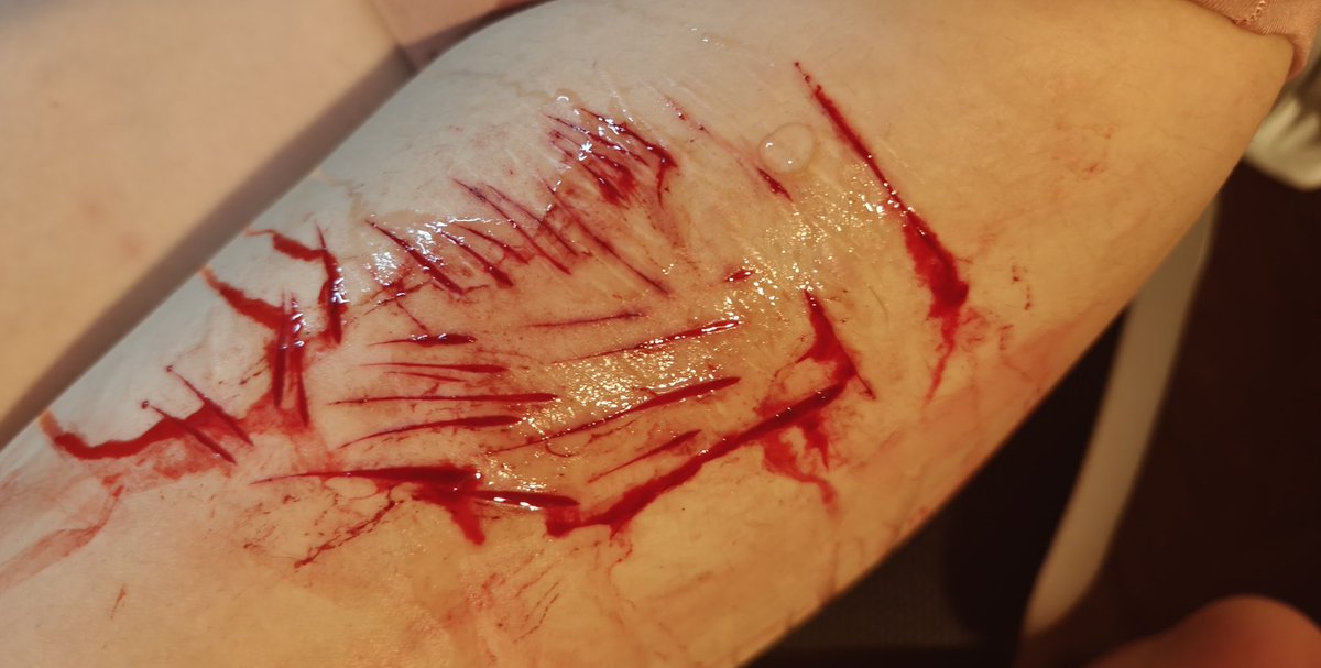 capyrexic's tweet photo. Trigguh Warnin https://t.co/nL0FHNHxkw