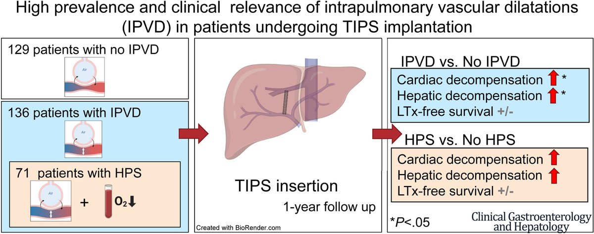 CGH (@aga_cgh) on Twitter photo Screening for IPVD before TIPS implantation could help to further identify patients at higher risk of CD and HD: ow.ly/U6U050Ts6SQ <a href="/Maasoumy_lab/">Maasoumy_liverlab</a> Screening for IPVD before TIPS implantation could help to further identify patients at higher risk of CD and HD: ow.ly/U6U050Ts6SQ <a href="/Maasoumy_lab/">Maasoumy_liverlab</a>