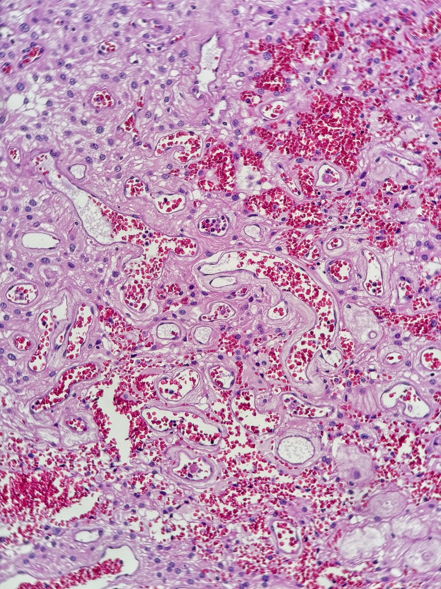 Gianni Ippoliti tweet media