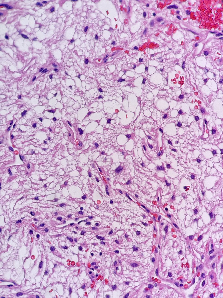 Gianni Ippoliti tweet media