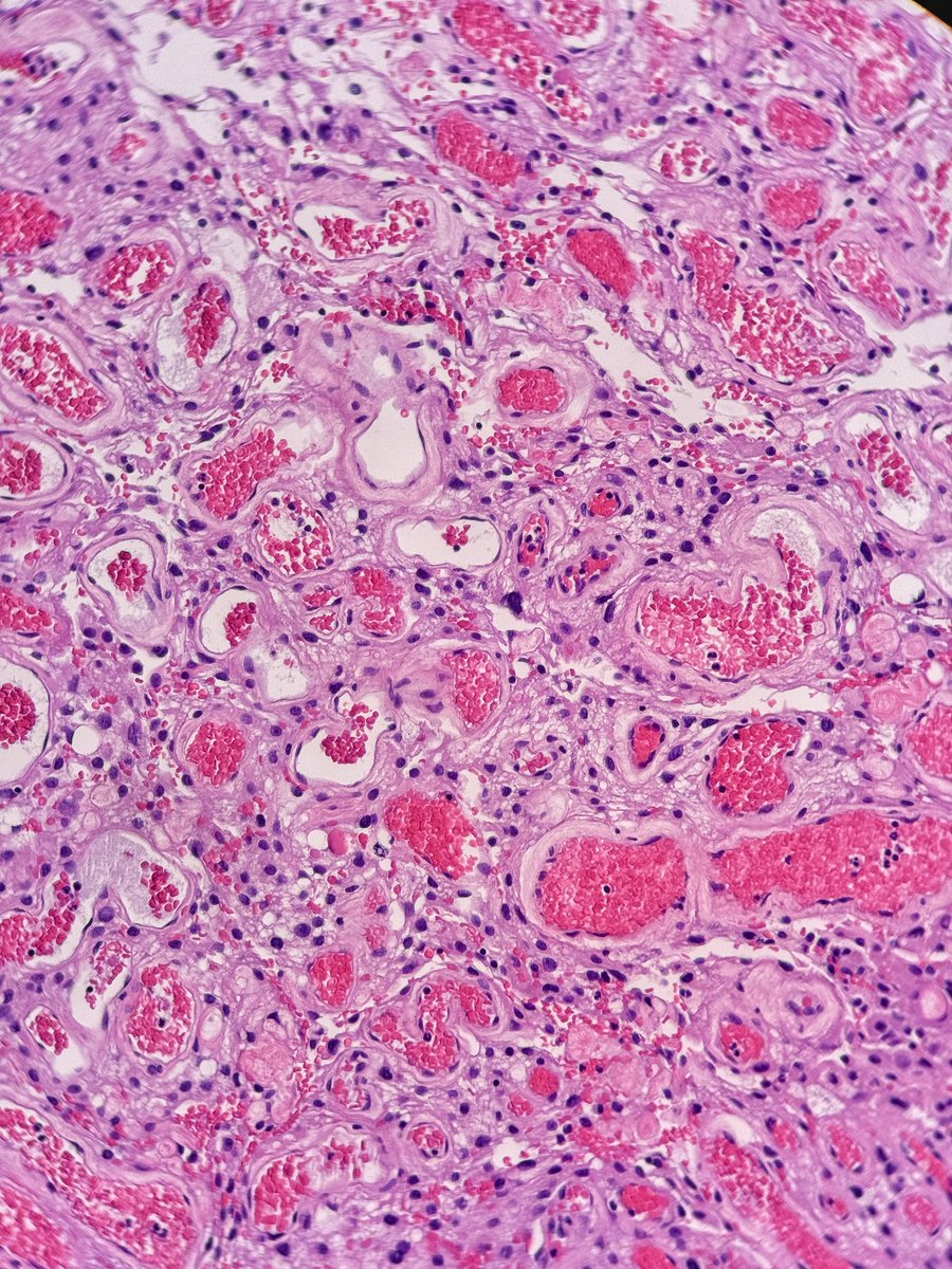 Gianni Ippoliti tweet media